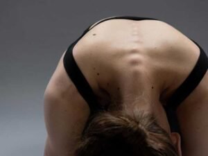 The Benefits of Integrating Physiotherapy with Scoliosis Treatment