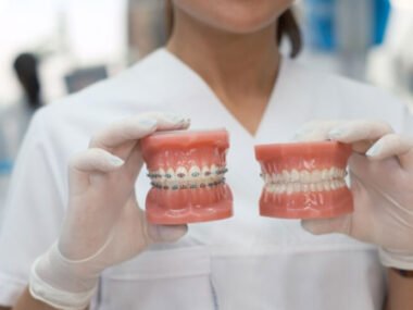 Exploring-the-Top-Dental-Alignment-Treatments-for-a-Perfect-Smile