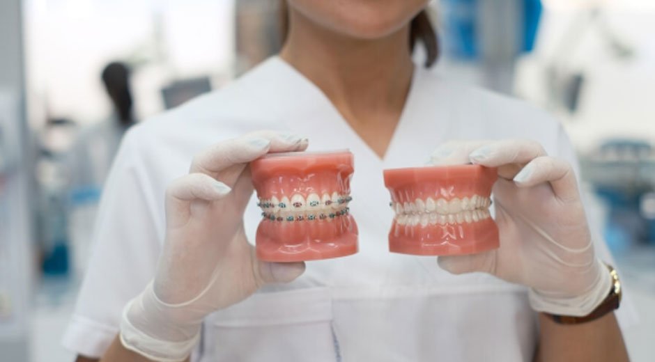 Exploring-the-Top-Dental-Alignment-Treatments-for-a-Perfect-Smile