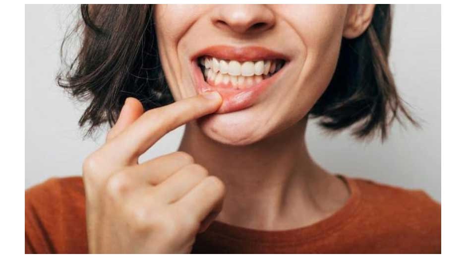 Why-Professional-Care-is-Essential-for-Managing-Gum-Disease